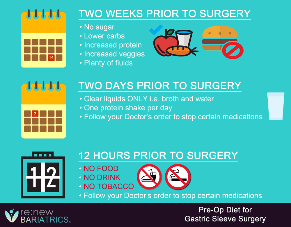 how to lose weight fast after gastric sleeve