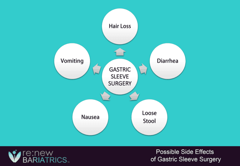 Side Effects of Gastric Sleeve Surgery Renew Bariatrics