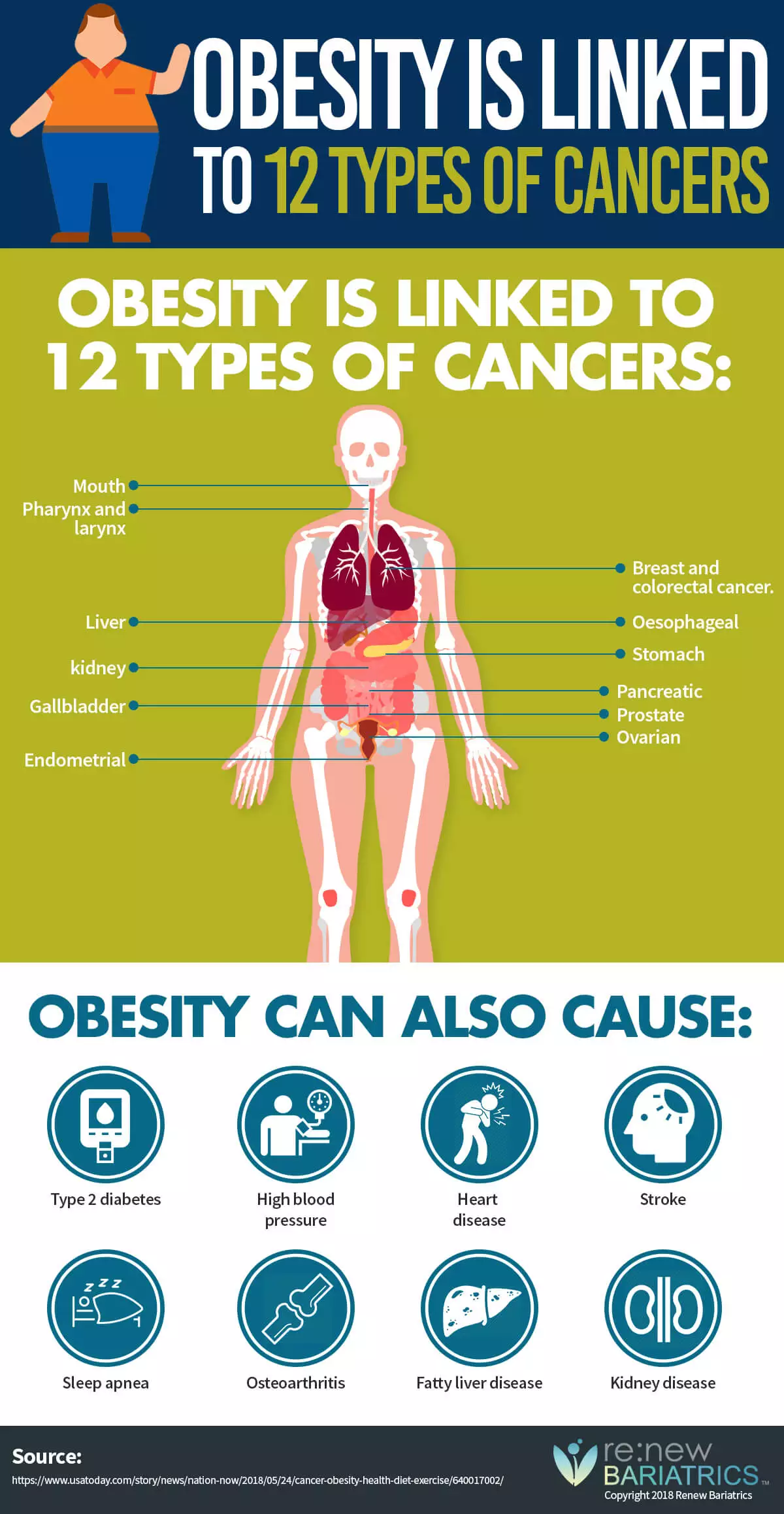 Obesity Linked to Cancers