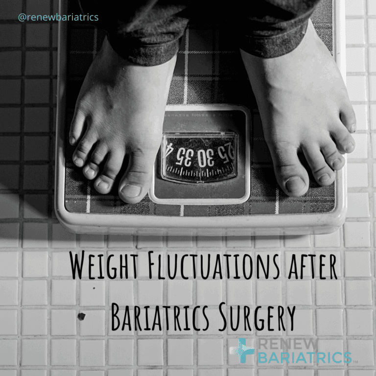 Weight Fluctuations after Bariatrics Surgery