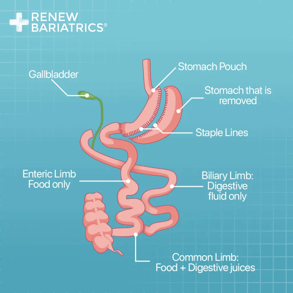 A comprehensive diagram displaying the anatomy of the digestive system with a focus on weight loss surgery cost and findings from the 2022 survey.