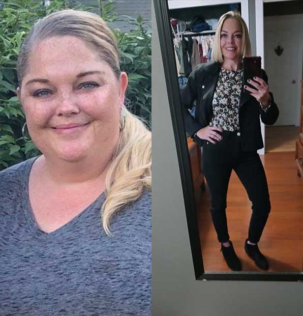 Misty Dodd takes a picture of herself before and after losing weight.