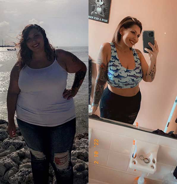 Gastric Sleeve success story [Sarah lost 160 lbs!] Advanced Bariatrics