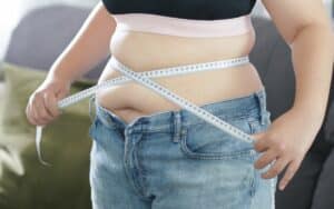 Yes, Your Stomach Will Stretch After Gastric Sleeve Surgery?