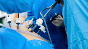 Minimally Invasive Bariatric Options in Mexico