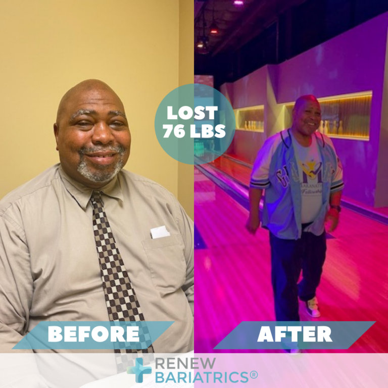 Bariatric Surgery Before and After Photos