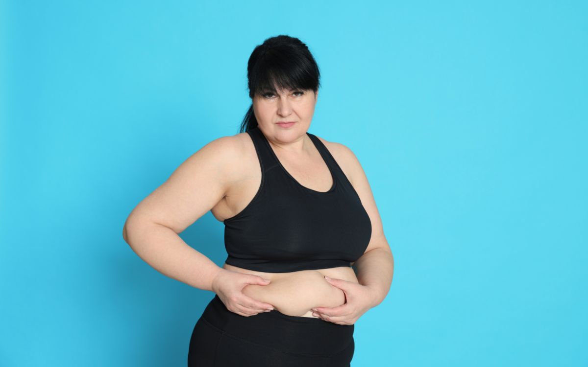 Renew Bariatrics weight loss surgery patient