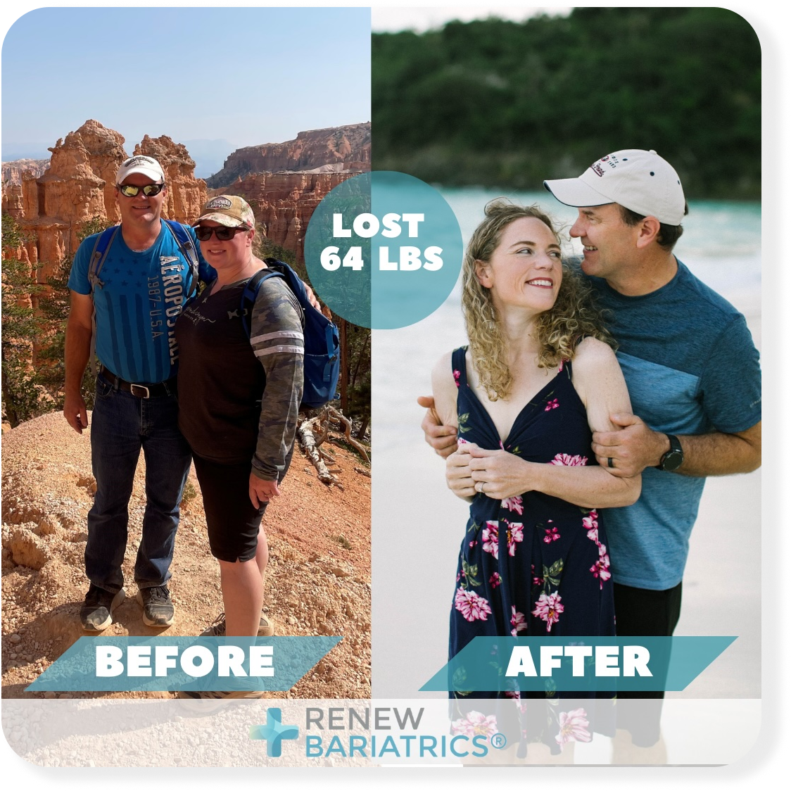 Meghan K. gastric bypass before and after photo, lost 64 lbs