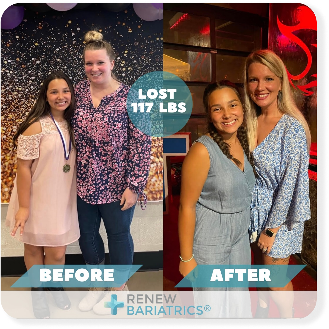 Asia H. bariatric surgery before and after photo, lost 117 lbs