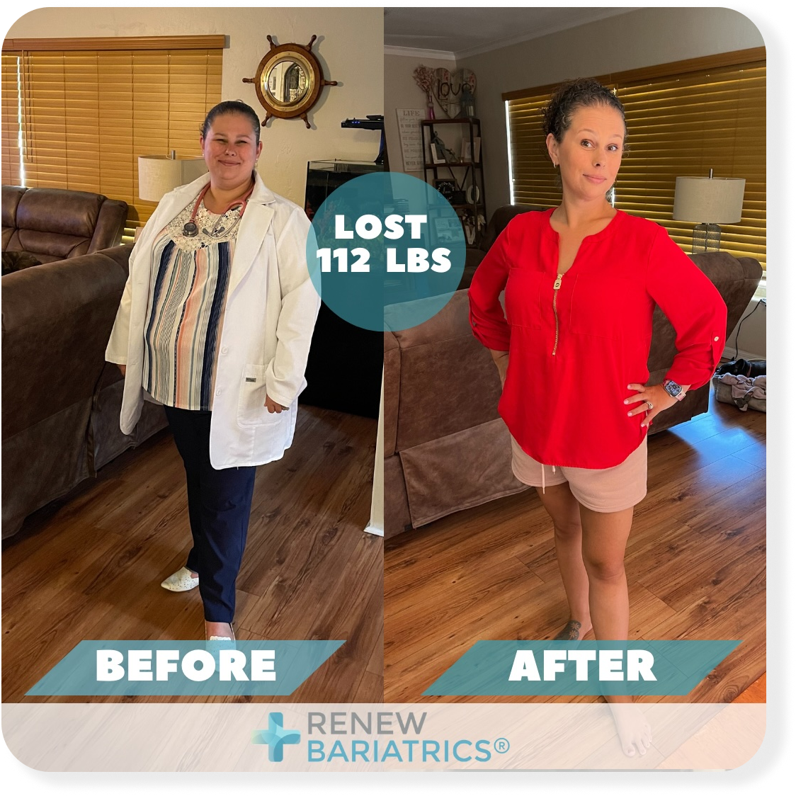 Stephanie H. bariatric surgery before and after photo, lost 112 lbs