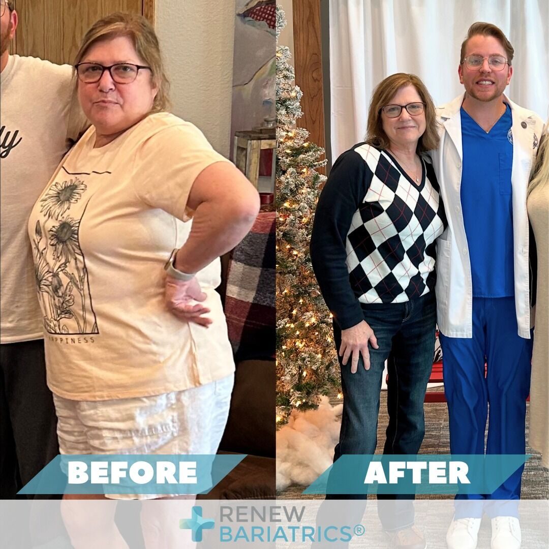 Catherine B. gastric sleeve before and after photo, lost 56 lbs
