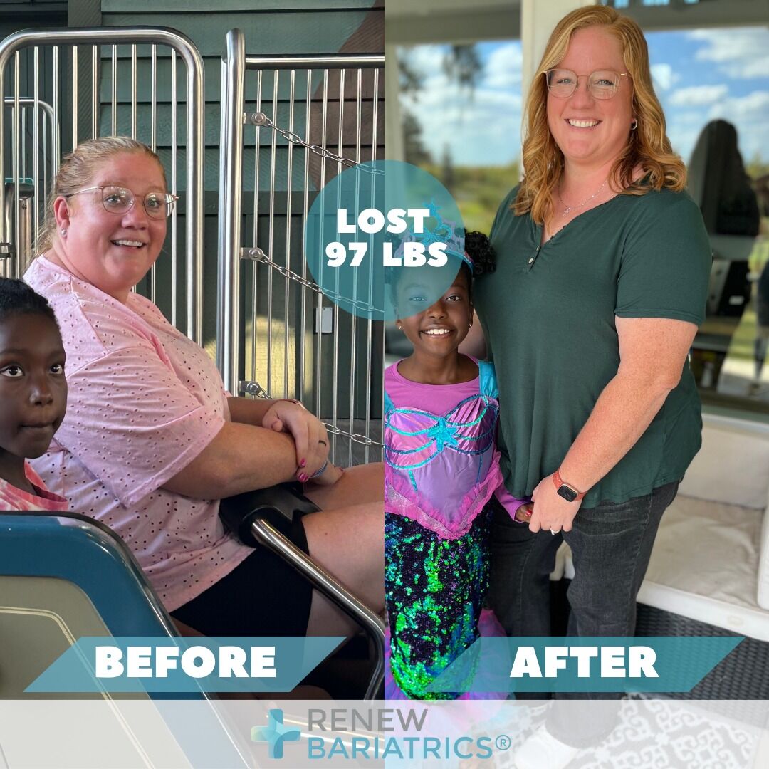 Chelsea B. gastric bypass before and after photo, lost 97 lbs