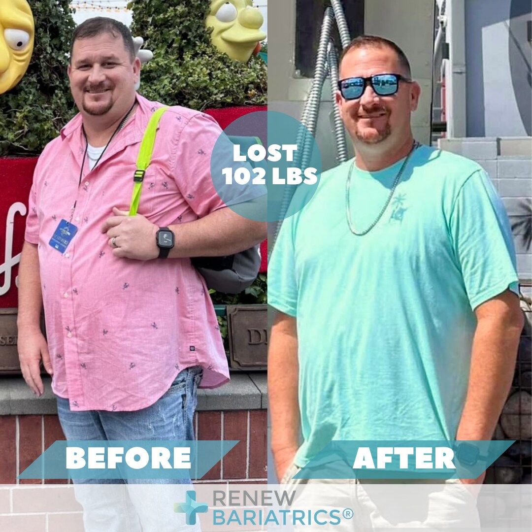 Eric M. gastric sleeve before and after photo, lost 102 lbs