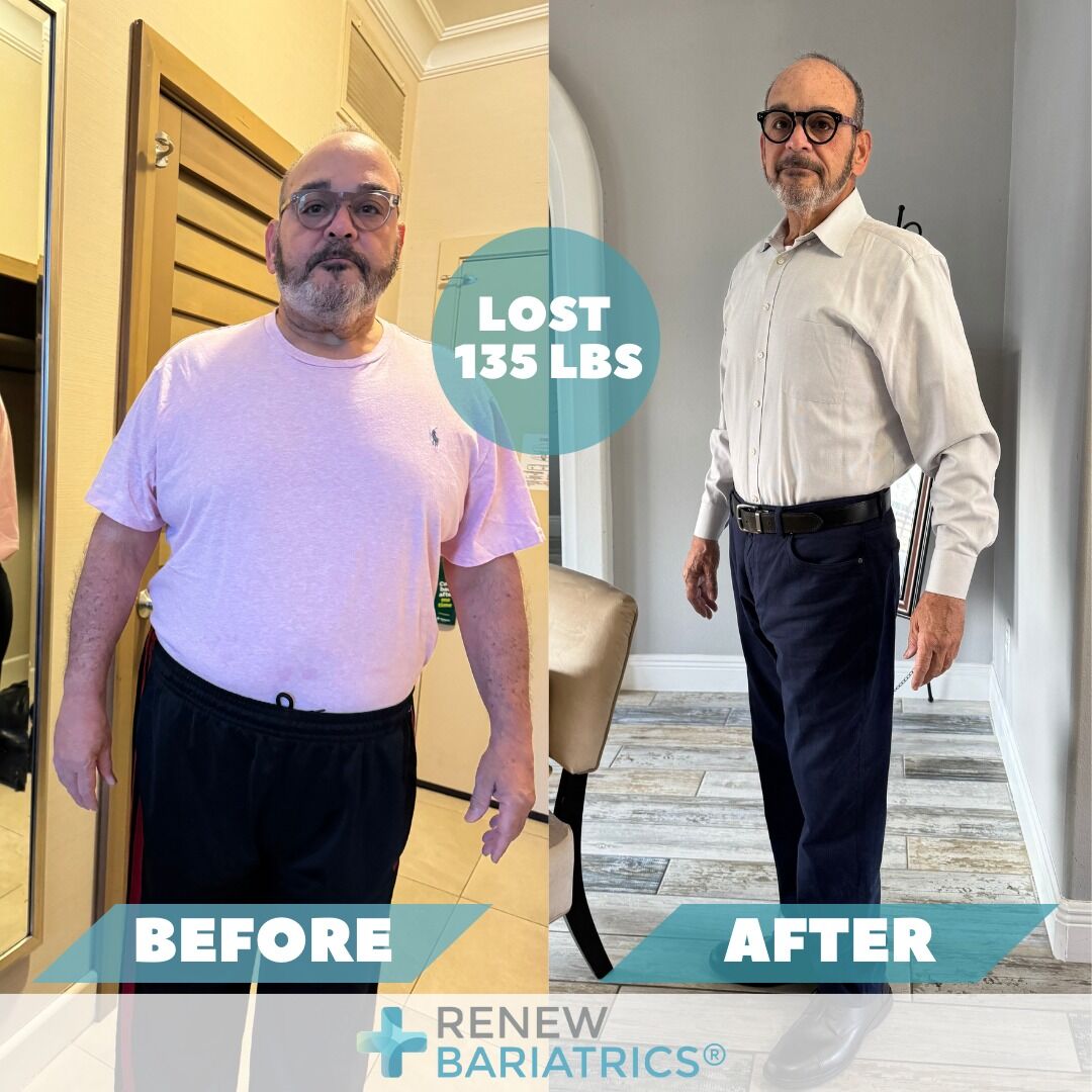 Heriberto H. gastric bypass before and after photo, lost 135 lbs