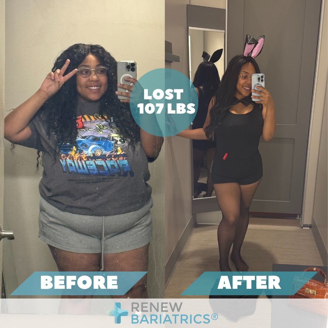 Jade R. gastric sleeve before and after photo, lost 107 lbs