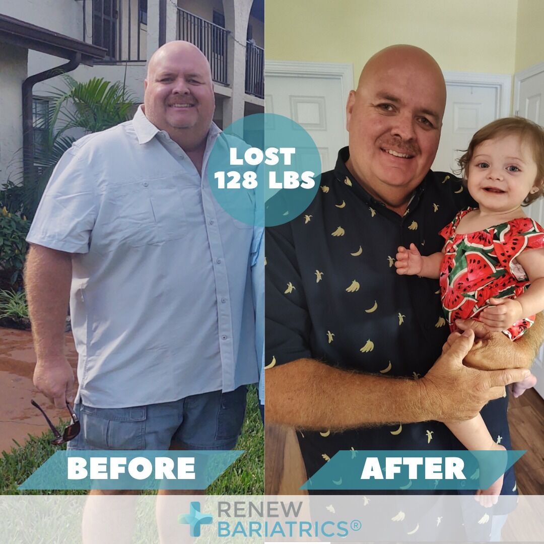 Jason W. gastric sleeve before and after photo, lost 128 lbs