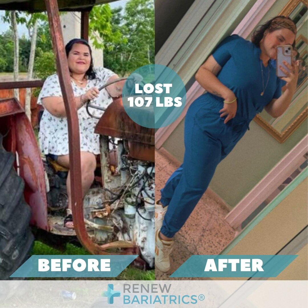 Julie G. gastric sleeve before and after photo, lost 107 lbs