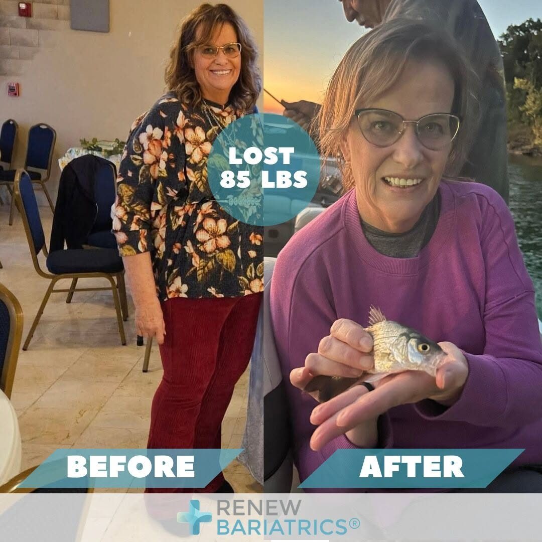 Julie A. gastric bypass before and after photo, lost 85 lbs