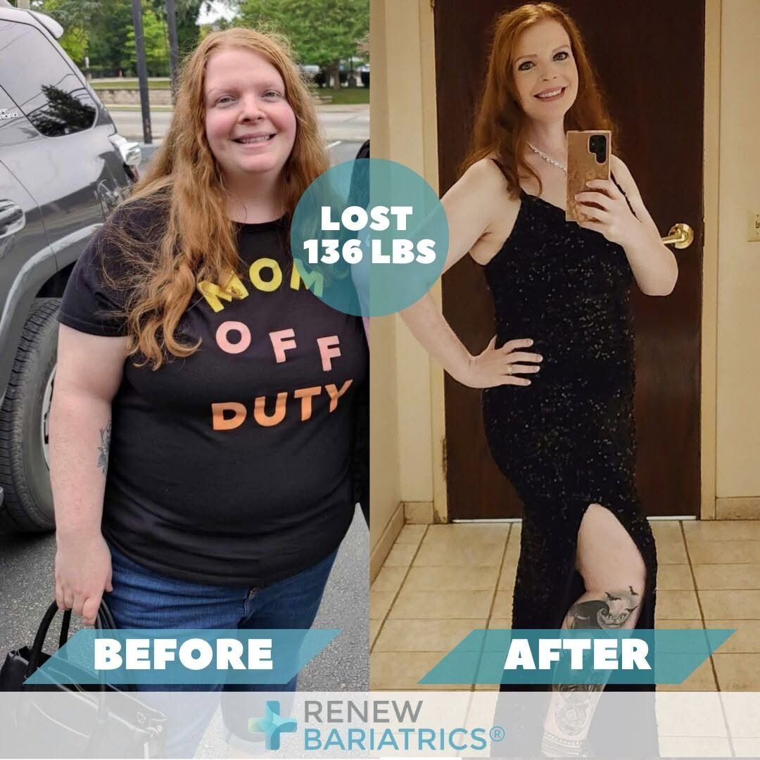 Kelly M. gastric bypass before and after photo, lost 136 lbs