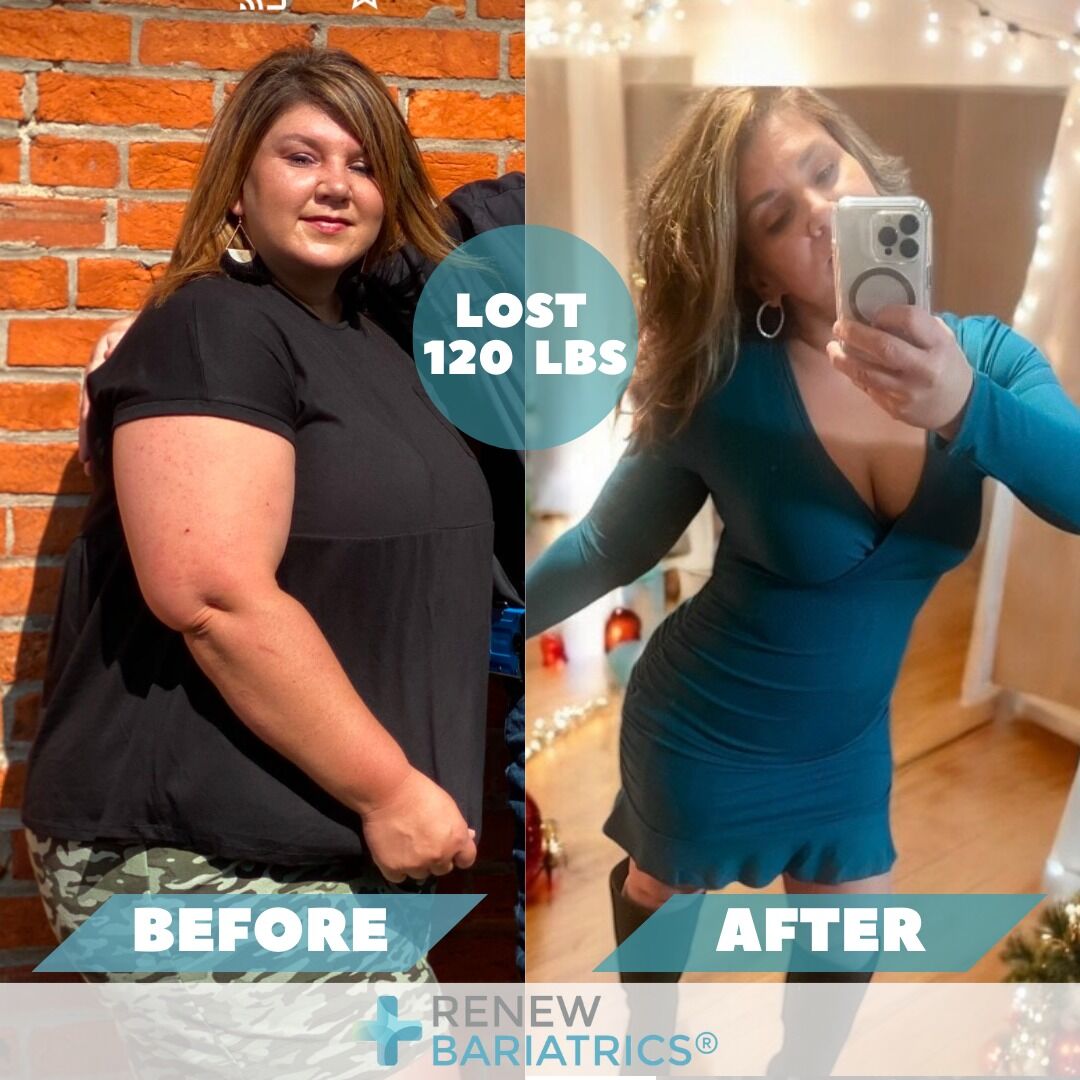 Kythern L. gastric sleeve before and after photo, lost 120 lbs