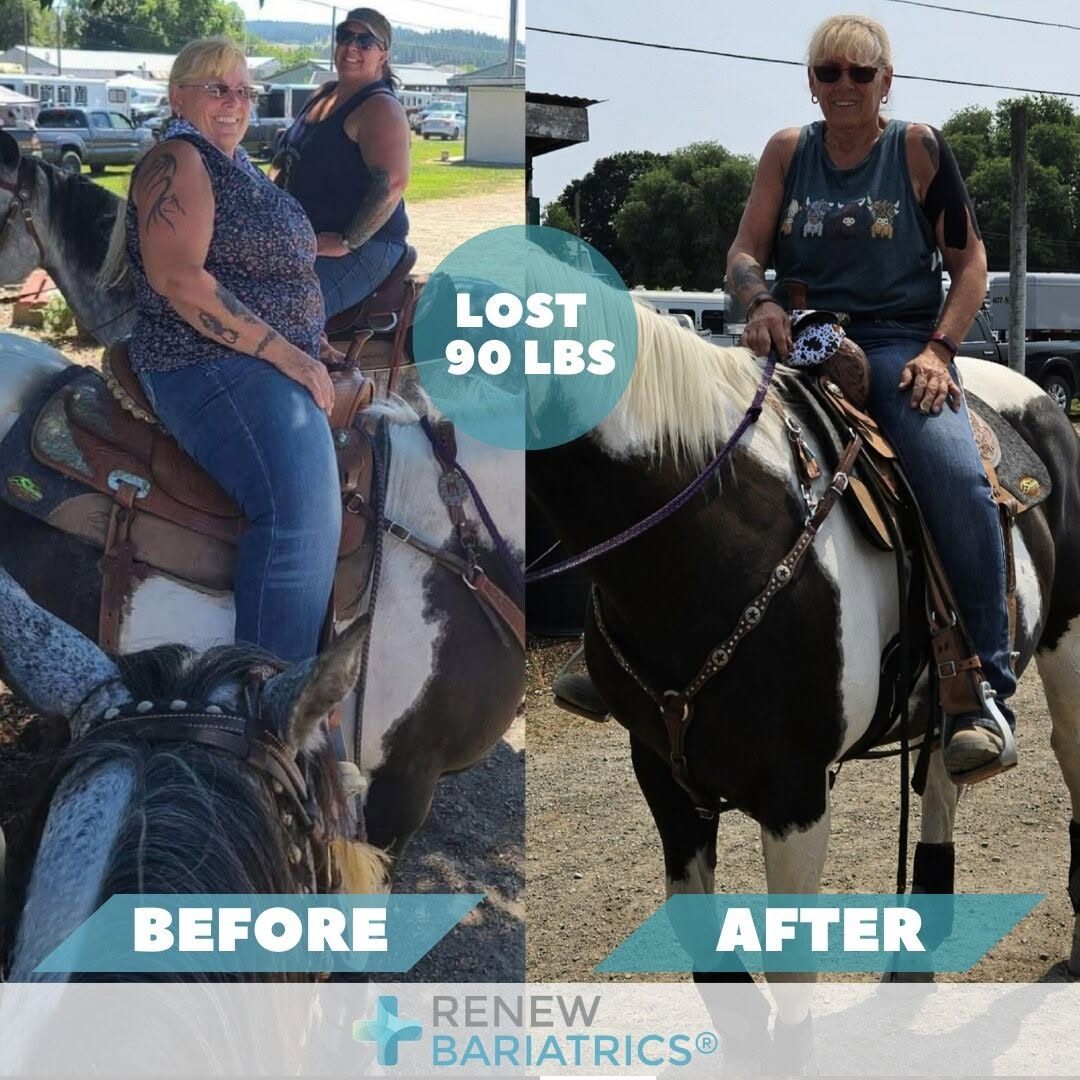 Lorraine M. gastric sleeve before and after photo, lost 92 lbs