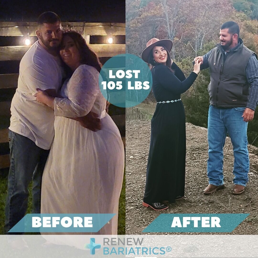 Megan B. gastric sleeve before and after photo, lost 105 lbs