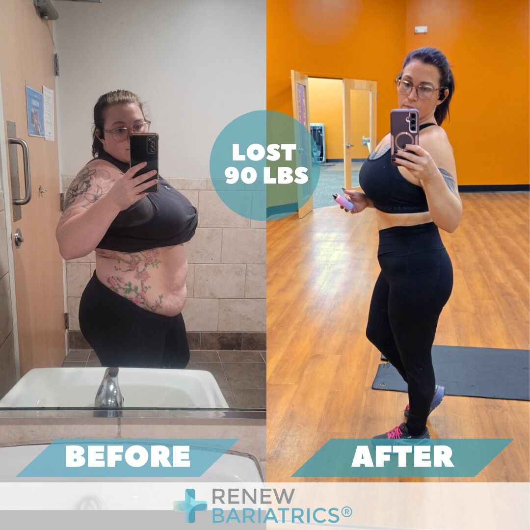 Serina H. gastric sleeve before and after photo, lost 90 lbs